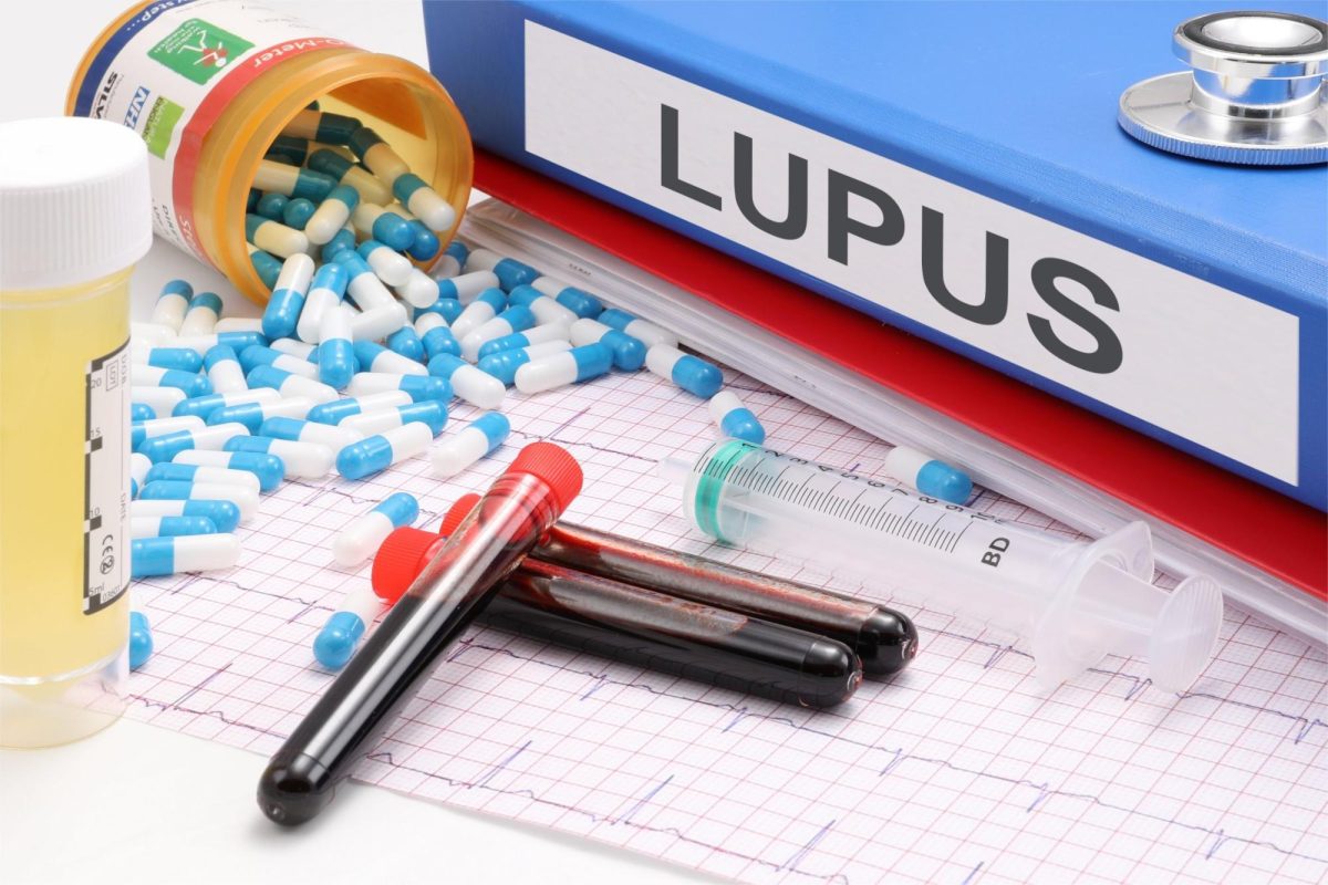 Lupus and other autoimmune diseases strike far more women than men